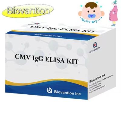 China CMV IgG ELISA Kit Pregnant Women Preventive Test High Accuracy zu verkaufen