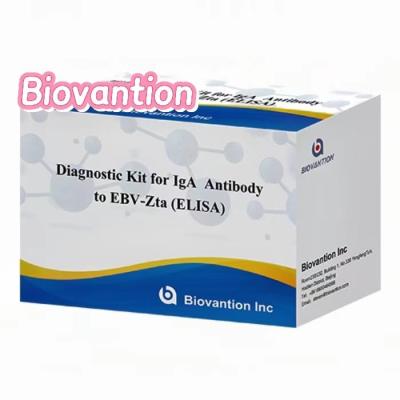 China Diagnostic Kit For IgA  Antibody  To EBV-Zta ELISA TEST KIT Immunosorbent Assay Test Kit for sale