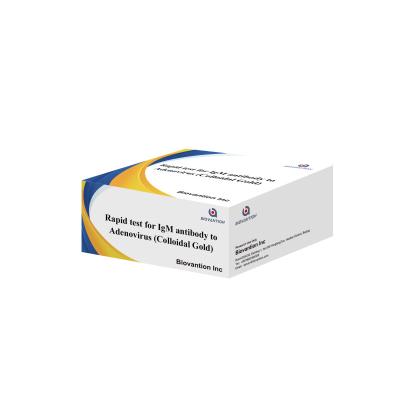 中国 Highly Sensitive Adenovirus IgM Rapid Test Colloidal Gold Rapid Test For Medical Professionals 販売のため