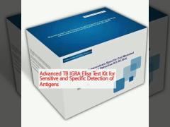 Advanced TB IGRA Elisa Test Kit for Sensitive and Specific Detection of Antigens