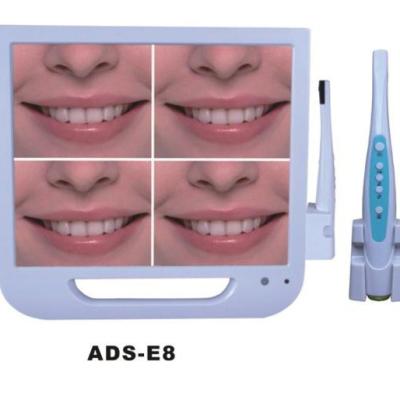 China Wireless Connect PC 17 Inch WIFI High Quality Dental Oral Camera To Intra/Dental Endoscope System With 1 Year Warranty for sale