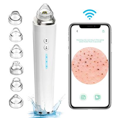 China Acne Treatment 20X Microscope With Camera WiFi Pimple Suction Extractor Tool Blackhead Remover Tool Visual Facial Vacuum for sale