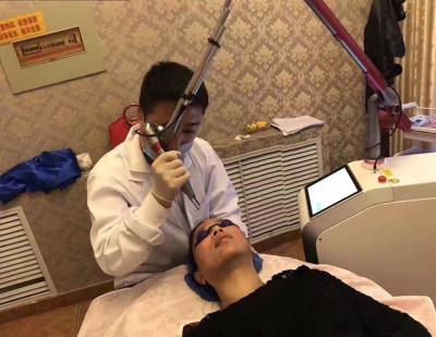 China q switch nd yag laser Hyperpigmentation removal,Mongolian Spot Nd:YAG laser manufacturer for sale