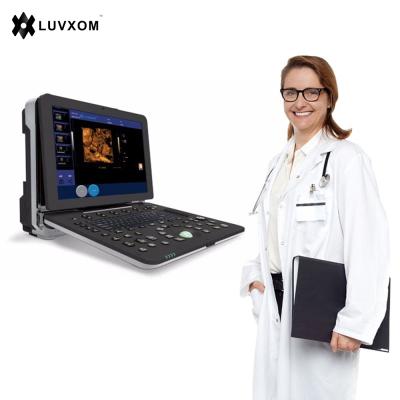 China OB LX-CB-P2 LUVXOM Color Ultrasound Machine Ultrasound Scanner Color Doppler Ultrasound Machine for sale