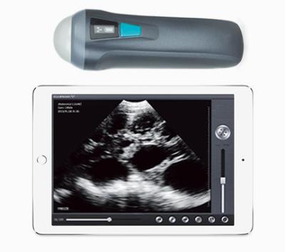 China LX-BP-1 Mini Wireless Plastic Handheld Portable Ultrasound Veterinary Ultrasound Machine for sale