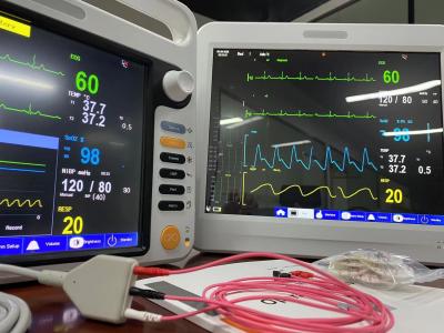 China Automatisierter Multi-Parameter-Vitalzeichen-Monitor für Neugeborenen-Diagnose-ODM zu verkaufen