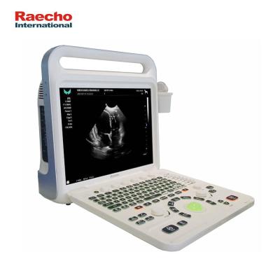 China Full Digital OB/GYN Raecho Color Doppler Ultrasound Diagnostic System For OB/GYN Abdomen for sale