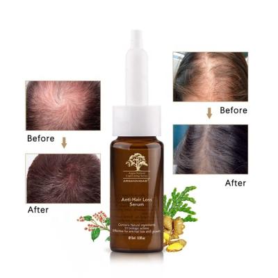 China Ginseng Keratin Tonic Hair Treatment Anti Hair Loss Prevention DHT Anti Hair Loss Prevention Hair Growth Oil for sale