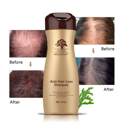 China Herbal Growth Hair Shampoo Anti Itchy Product Anti Dandruff And Anti Hair Loss for sale