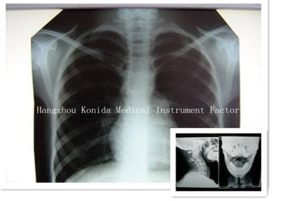 China Filme seco médico de X Ray de Digitas filme radiográfico da imagem latente da saúde de 14 x de 17in à venda