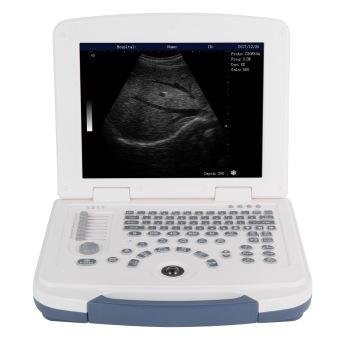 China 100% Guaranteed Portable Ultrasound Diagnostic System With Cheap Price Ultrasound Scanner for sale