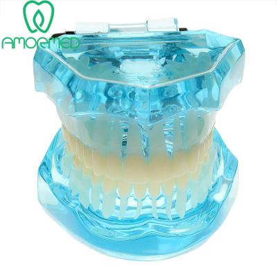 China 2018 Hot Sale Plastic Standard Dental Model For Educational for sale