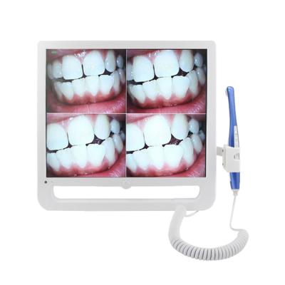 China S113 Intraoral Dental Regional Portable Wireless Oral Camera with 17 inch LCD Monitor for sale